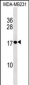 PLAC1 Antibody (C-term)